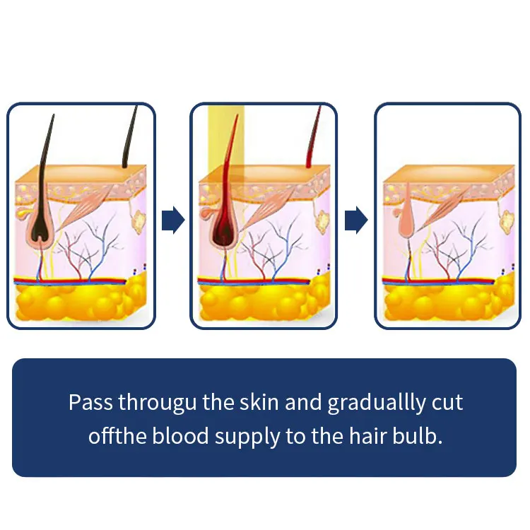 Alma soprano titanium 755 808 1064 laser hair removal machine price