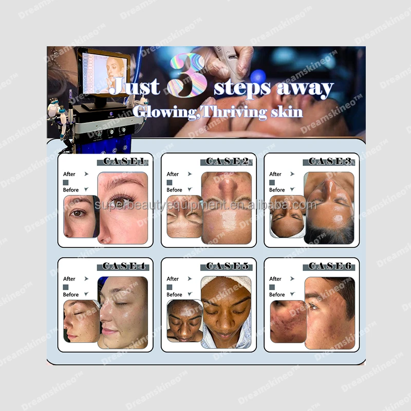 New Arrival Face Serum Ginseng Essence Anti -Wrinkle for face tips Advanced Wrinkle Reducing Face Serum ampoules