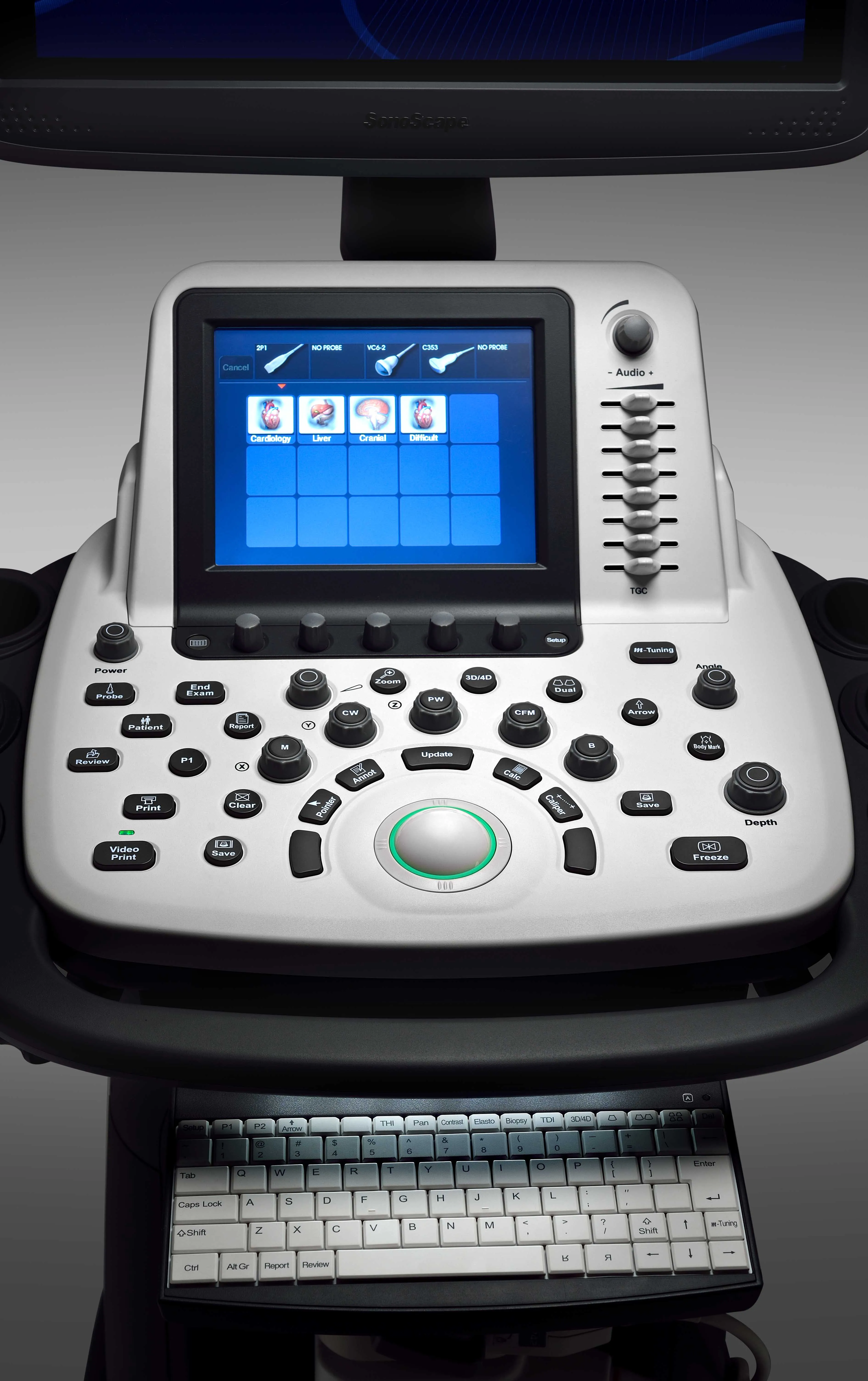 double screen Sonoscape S22 trolley color doppler ultrasound machine professional hospital and clinic