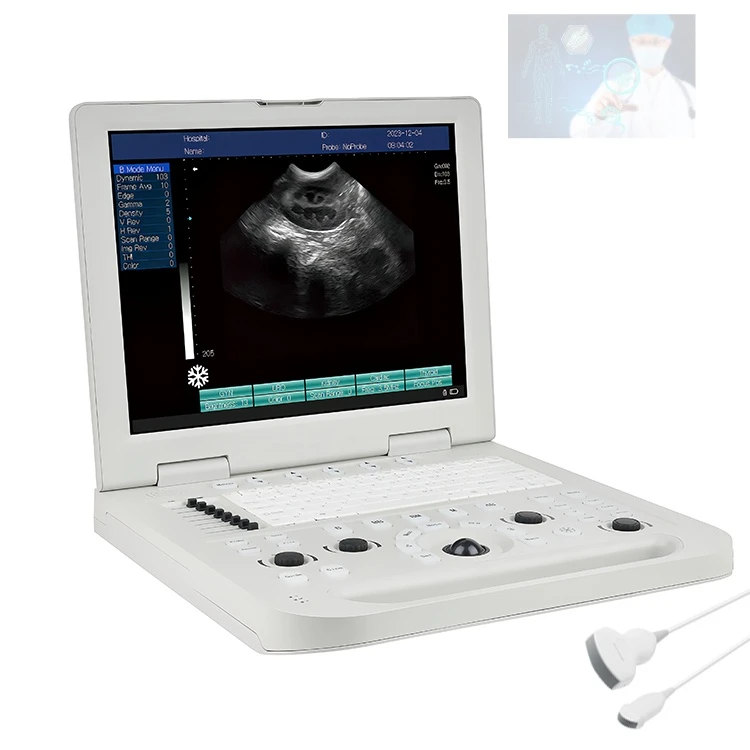15 Inches Portable Ultrasound Machine Full Digital 2D 3D Portable Ultrasonido Pregnancy Scanner with Convex Probe