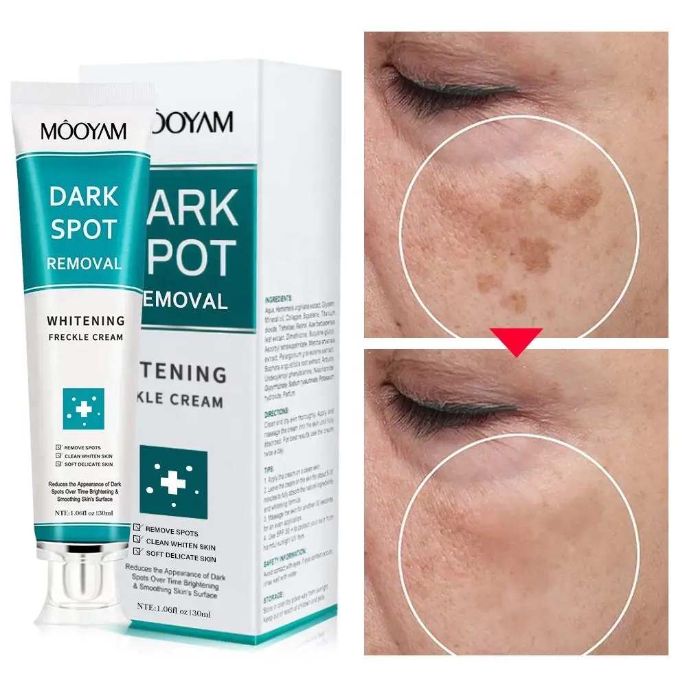 Hot Sale OEM Dark Spot Removal Cream Moisturizeing Brightens the Complexion 30g MOOYAM Whitening Dark Spot Removal Cream