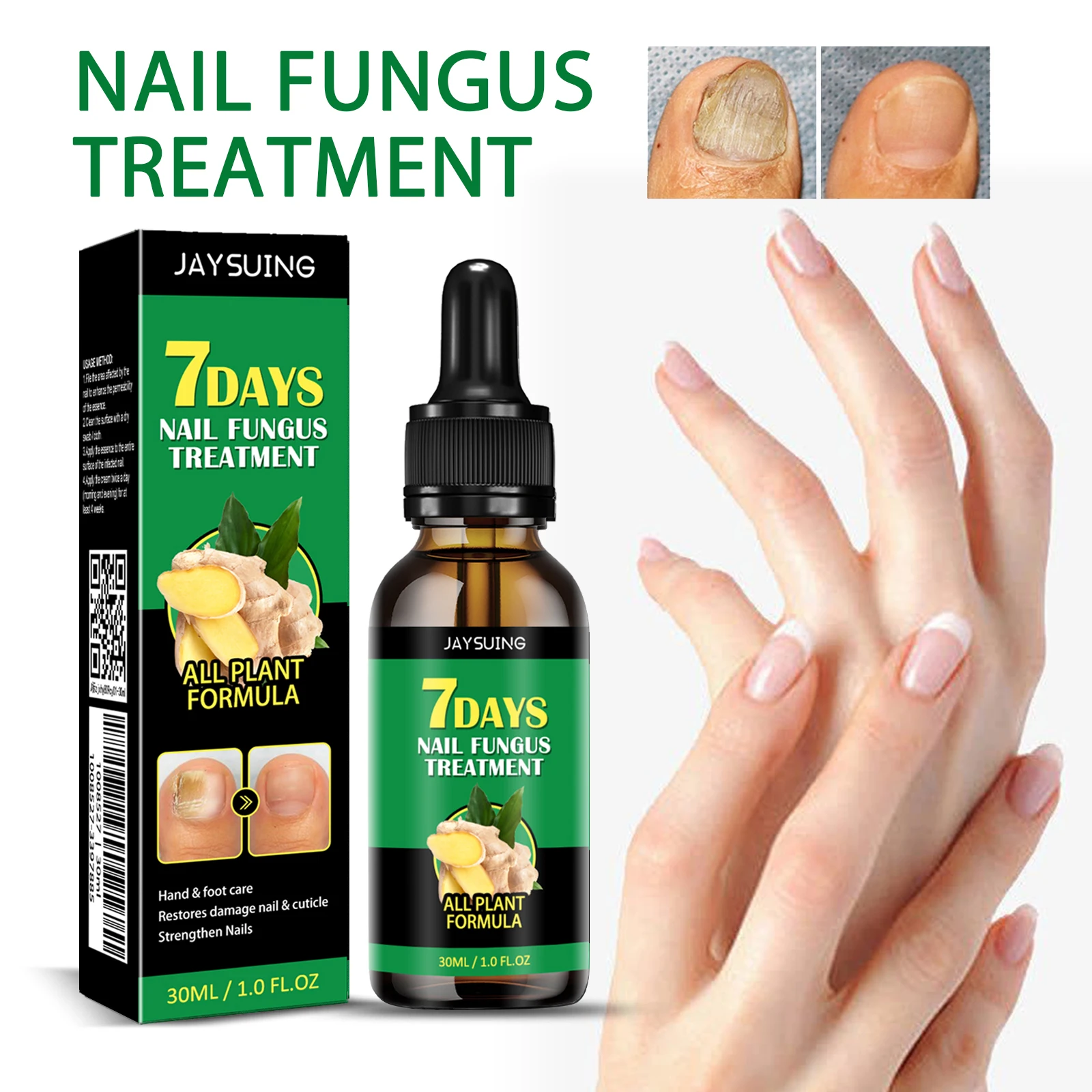 Hot Selling Wholesale Foot Care Cuticle Strengthen Nails Remove Onychomycosis 7 Days Fungal Nail Theatment Repairing Serum
