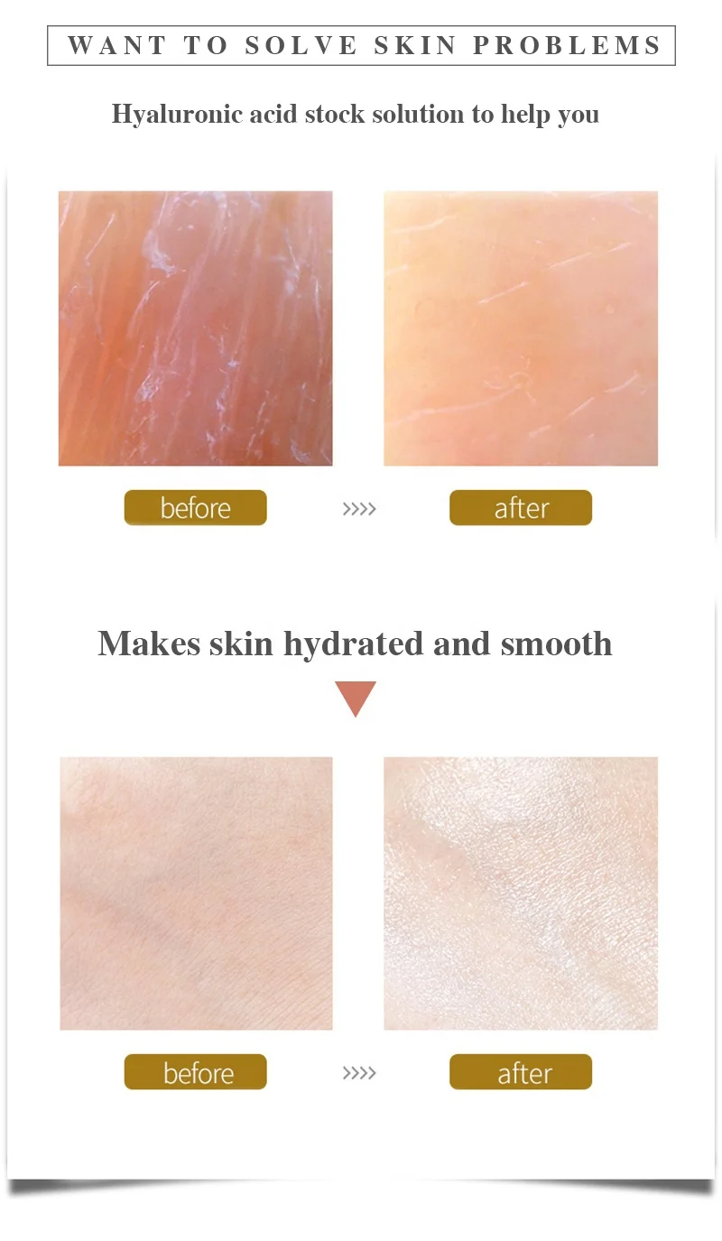 Low Moq Collagen Hyaluronic Acid Ampoule Serum Face Skincare One-time Use Hyaluronic Acid Ampoule Serum Collagen Serum Ampoule