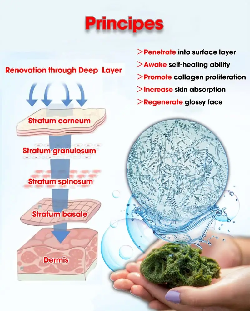 Hot sale 70% Treatment III Spicule Spongilla Spicules Acne skin Cream with Sea Buckthorn Oil