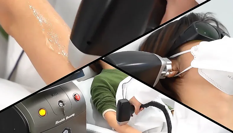 Summer promotion prices laser hair removal beauty cosmetic equipment 808nm diodo lazer