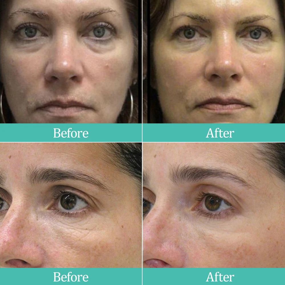 Women Beauty Silicone LED Face Mask 630nm Red Light Photon Therapy Mask Skin Rejuvenation Anti-Aging LED Facial Hand Neck Masks