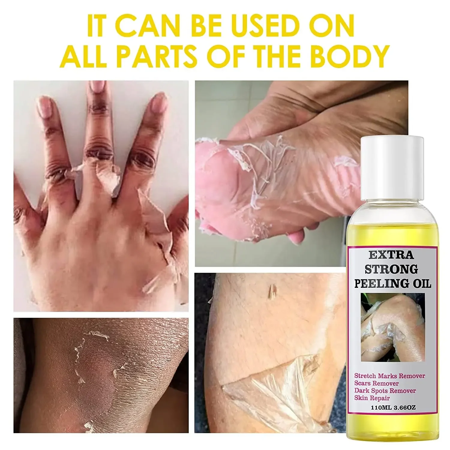 Yellow Peeling Oil Skin Whitening Stretch Marks Removers Scar Remover Dark Spot Remover Strong Green Yellow Peeling Oil
