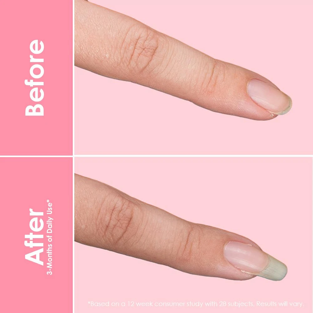 Private Label Support Skin Health Natural Citrus Flavor Vegan Gummy Supplement Collagen Gummies