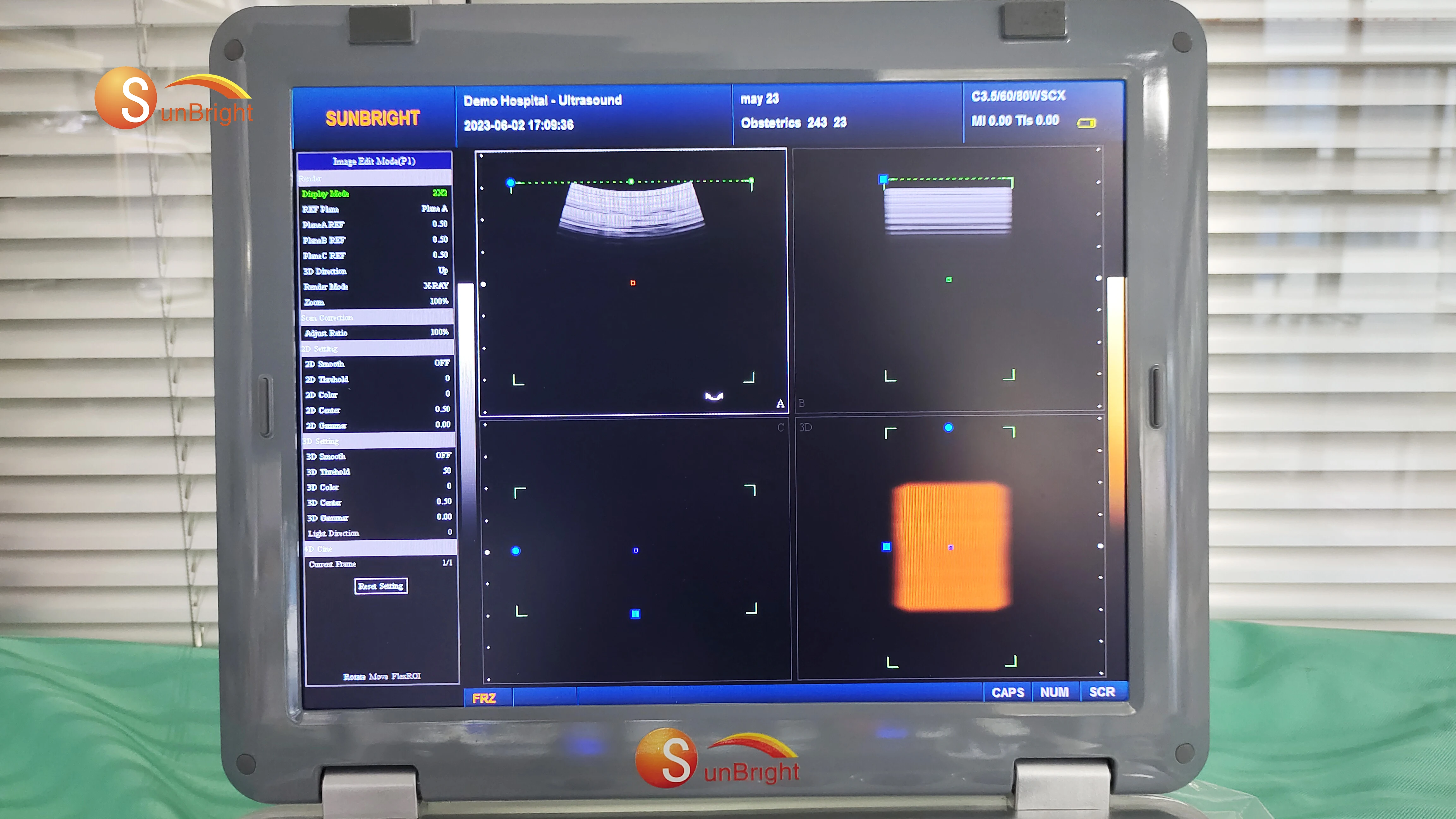 Cheap Laptop 3D doppler Ultrasound Portable Ultrasound Machine Echo SUN-800F