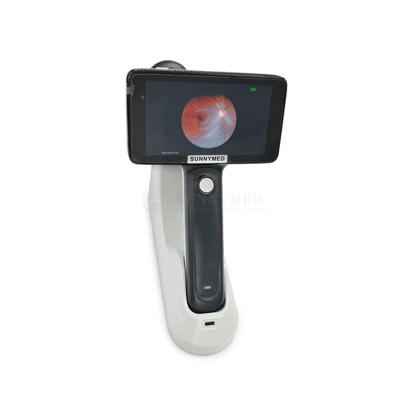 SY-V042A Ophthalmic Optometry Fundus Camera Handheld Portable New Designed Customized Products
