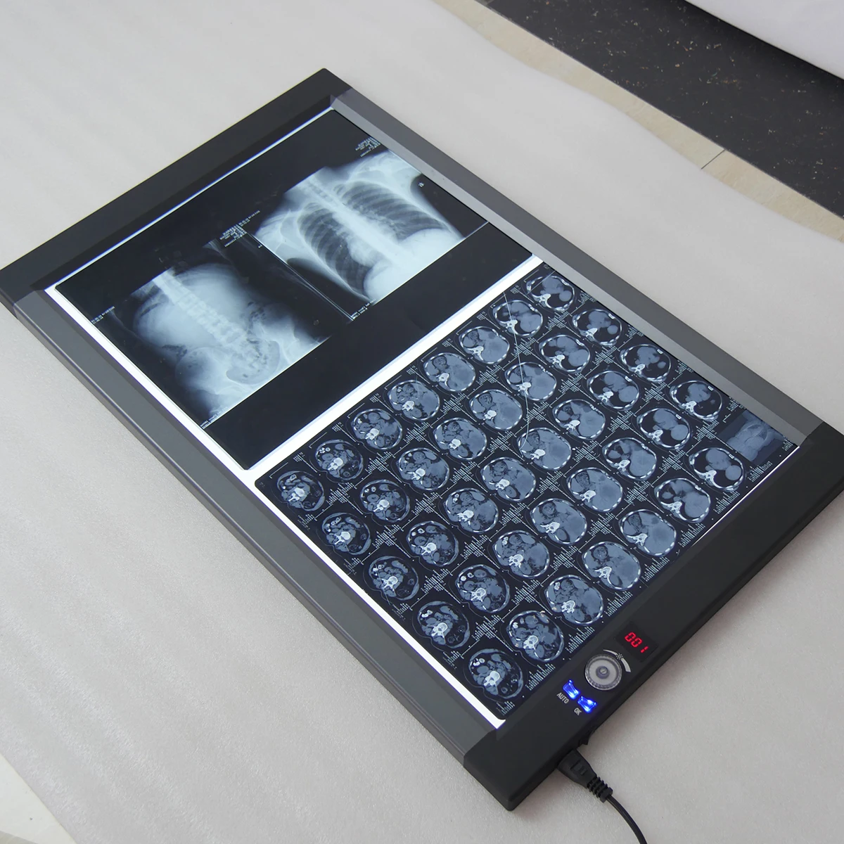 
Double Panel Medical LED X-ray Film Viewer X-ray Viewing Light MSLZG2C 