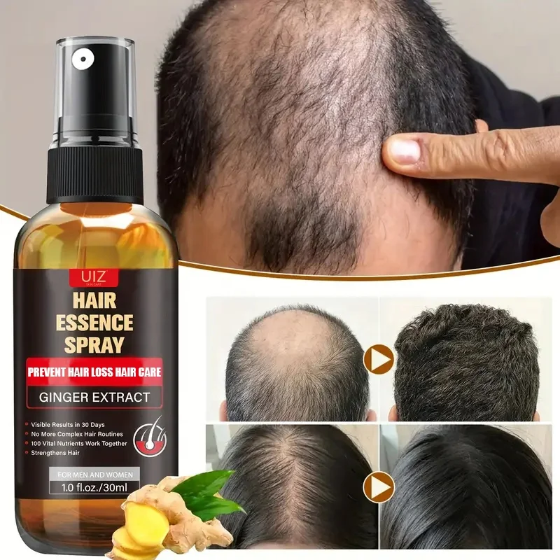 Fast Growth Ginger Hair Oil Spray Anti Hair Loss Treatment Regrowth Thicken Hair Growth Oil Serum For Men And Women