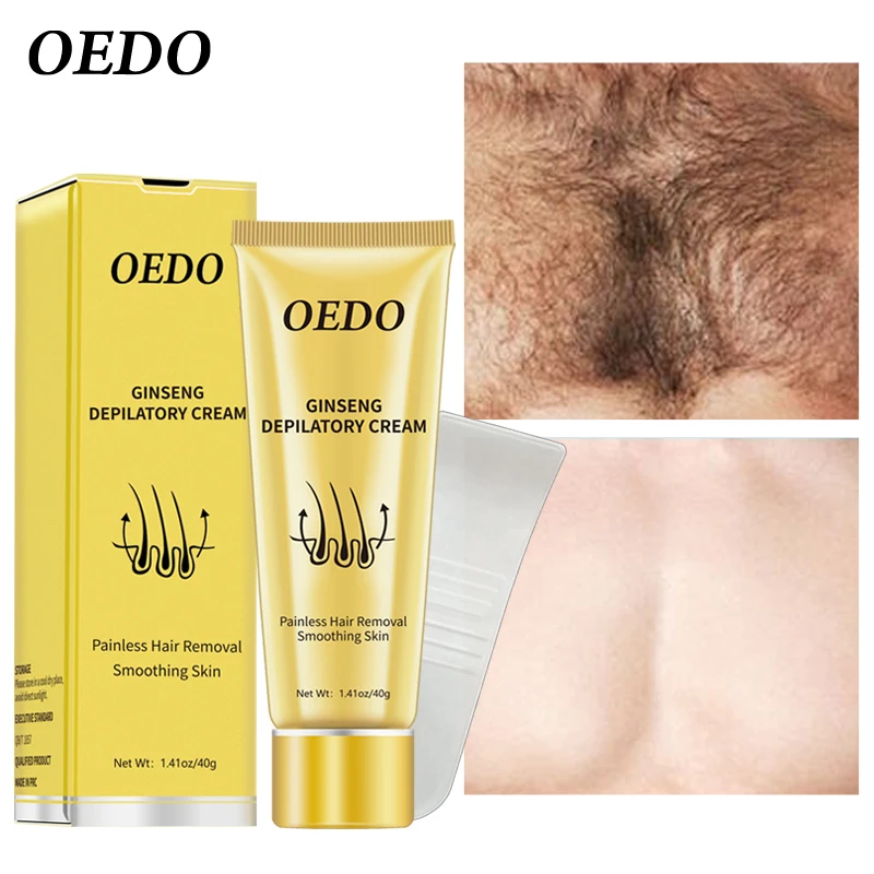 Крем для удаления волос с женьшеня для мужчин и женщин, эпиляционный крем для выпадения волос у рук и ног, уход за волосами в подмышках, депиляционный крем