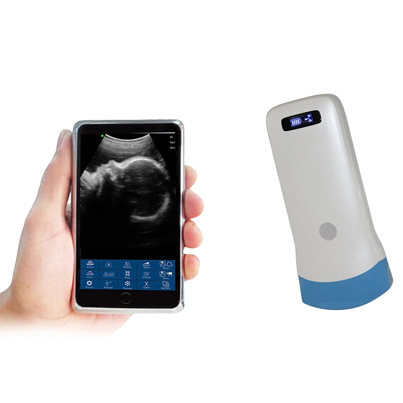 Abdominal Real-Time United Imaging Full Digital Veterinary Pregnancy Portable Wireless Ultrasound Scanner