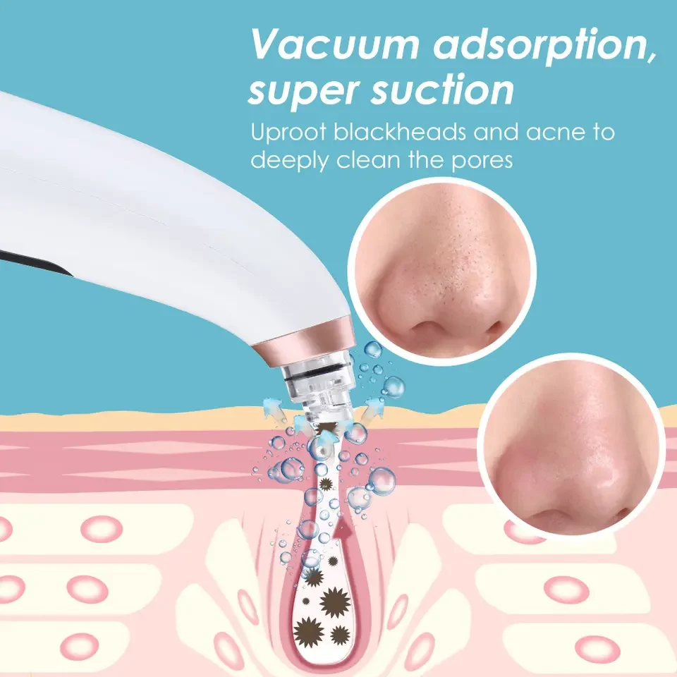 2023 Hot Electric Pimple Removal Suction Extractor Tool Kit Heated Vacuum Blackhead Remover Face Pore Cleaner