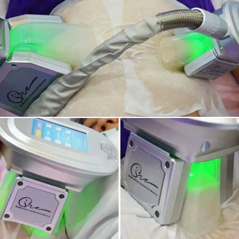 Anti Freeze Membranes For Cryolipolysis Film Cryo Treating Anti Freeze Membranes Fat Antifreeze Pads Criolipolisis Membranes