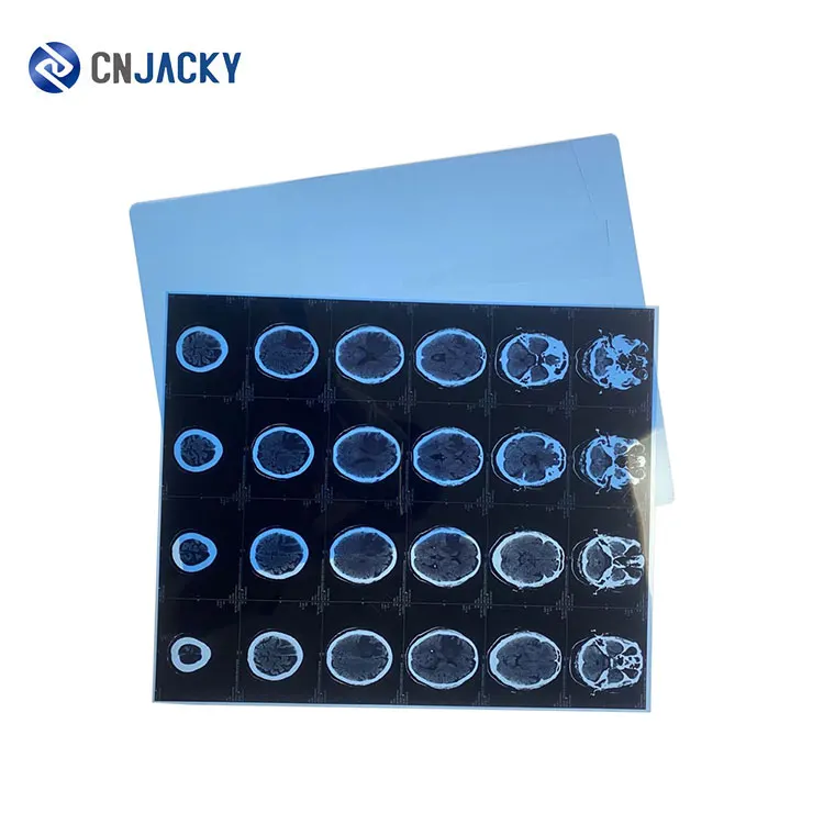 Cheap medical blue green sensitive medical dental x-ray film