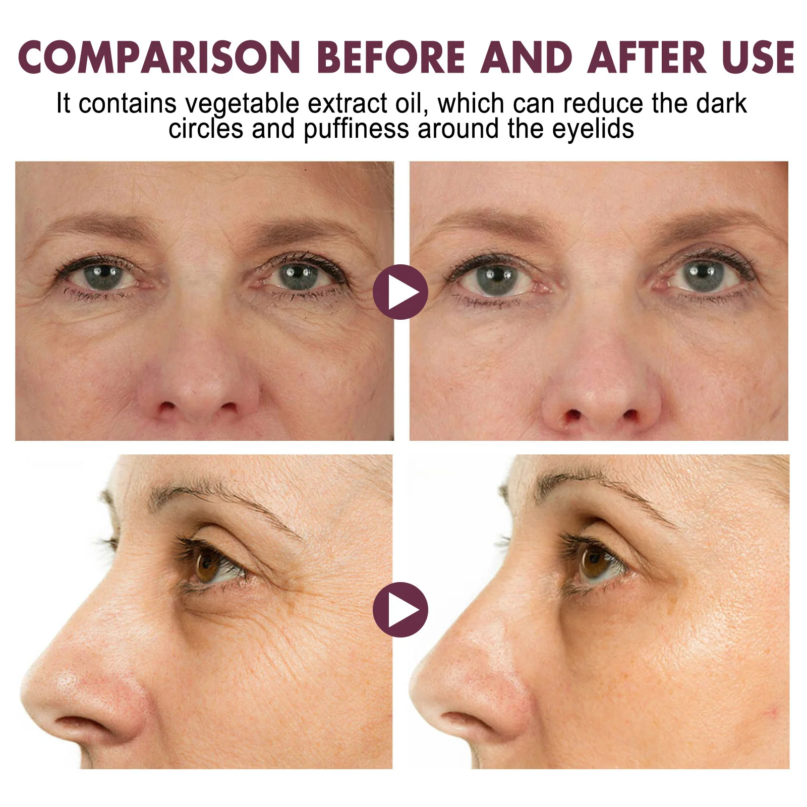 Diminishing fine lines dark circles eye bags moisturizing anti wrinkle firming eye repair cream