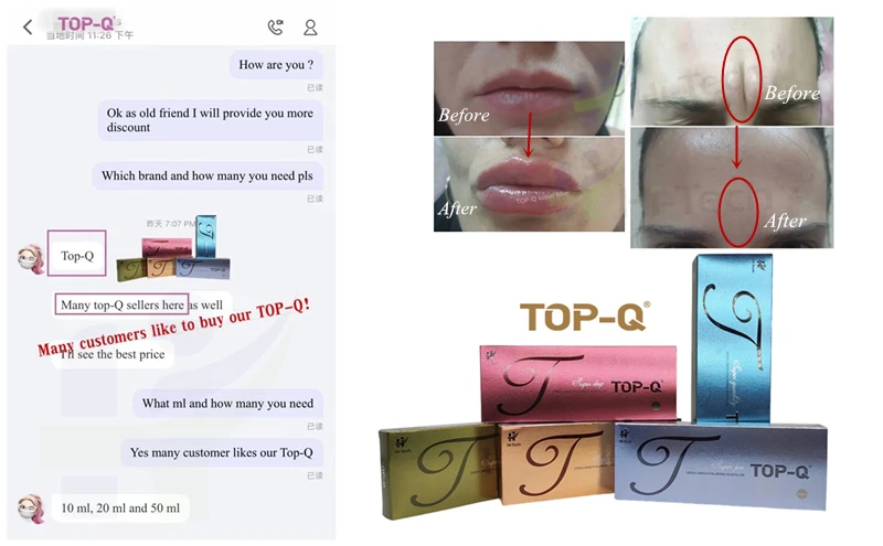 Hot-selling Injectable Cross Linked Hyaluronic Acid Syringe Ha Filler Injection Dermal Filler