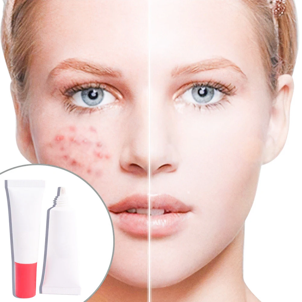 OEM Hyaluronic Skin Care Set Sensitive Skin Retinol Anti Acne Scar Cream Azelaic Acid Face Serum Silicone Female Vegina 5000