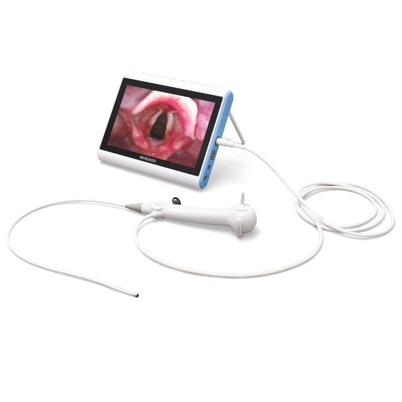 Factory medical endoscope 2.8mm/3.8/4.8mm Urethrascope Laryngoscope Bronchoscopy Ent Video Flexible Endoscope