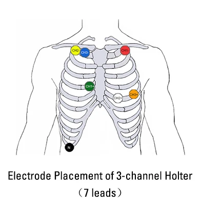 ECGMAC new 1.77 inch color OLED display 12 channel 3 channel holter monitor ecg
