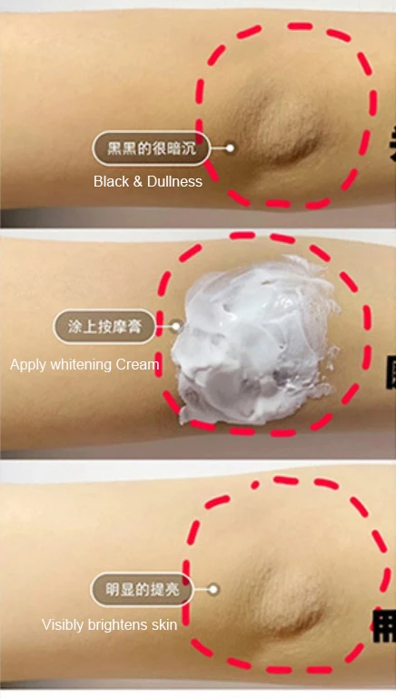 Hot sales Private label OEM skin moisturising lightening body bleaching  dark spot removing skin whitening cream