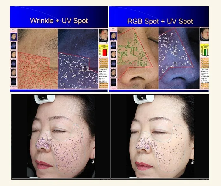 Professional mirror 3d visia skin analyzer machine uv camera scanner facial analize face diagnostic device portable analysis