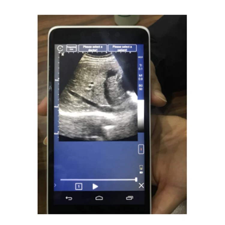 Healson Medical Ultrasound Machine With Color Doppler Usg