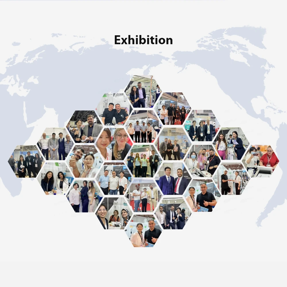 808nm diode laser 4 wavelength 755 808 940 1064nm diode laser hair removal machine