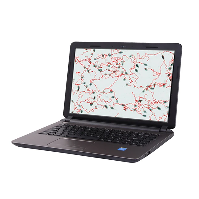 Animal sperm analyzer sperm quality analyzer