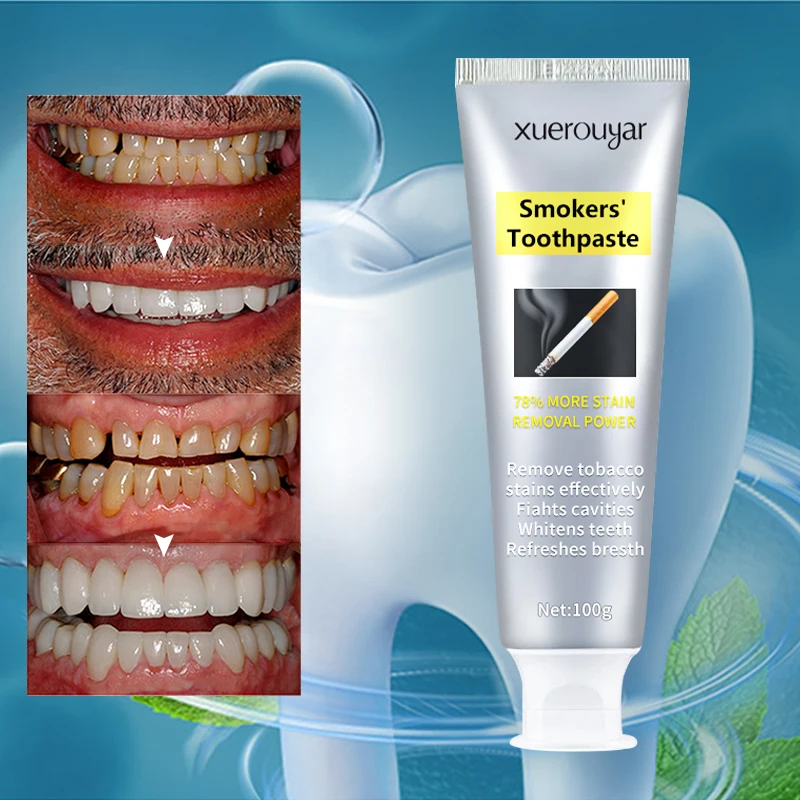 Private Label Stain removal whitening toothpaste Factory Price Bad Breath Care Teeth Whitening Smokers Toothpaste
