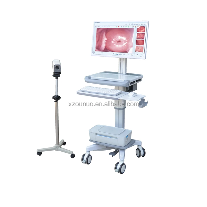 Selling low price HD colposcope for gynecological examination
