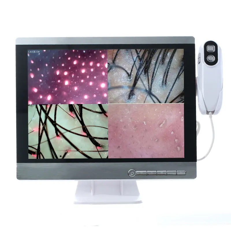 Wireless scalp scanner camera HD hair follicle hair skin analyzer to take photos and video analysis