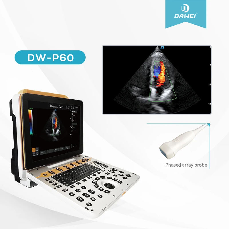 DAWEI P60 4D Portable Color Doppler Human Ultrasound Gynecology Cardiovascular Echo Machine Sale scanner with CE&ISO certificate