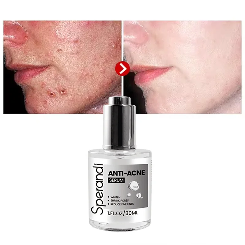 Pore Refining Facial Serum Private Label Dark Spot Removal Korea Whitening Niacinamide Azelaic Acid Magic Serum For Acne Pimples