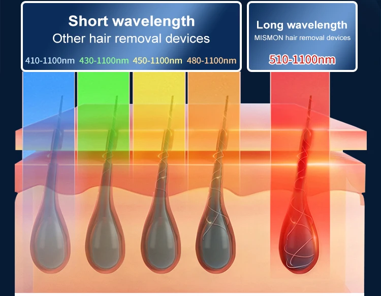 2022 Mismon Home Use Sapphire Electrolysis IPL Hair Removal 999999