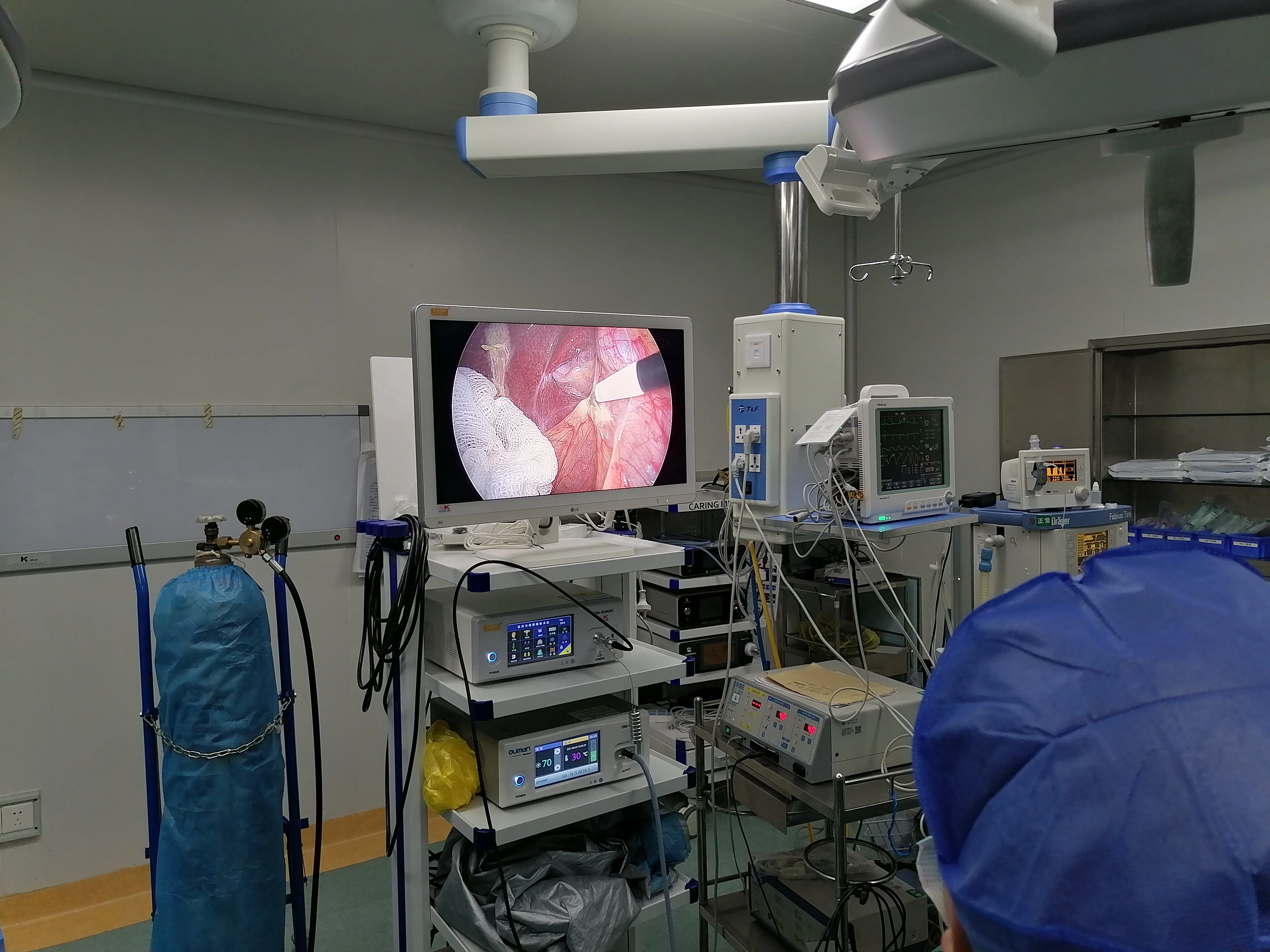 Medical Grade Monitor 27 inch Surgical monitor for Endoscopy ENT Hysteroscopy Laparoscopy