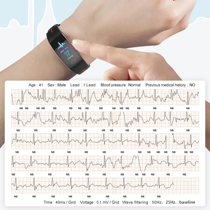 Smart Bracelet PPG ECG HRV Heart Rate Blood Oxygen Temperature Monitor Color Screen Smart Wristband