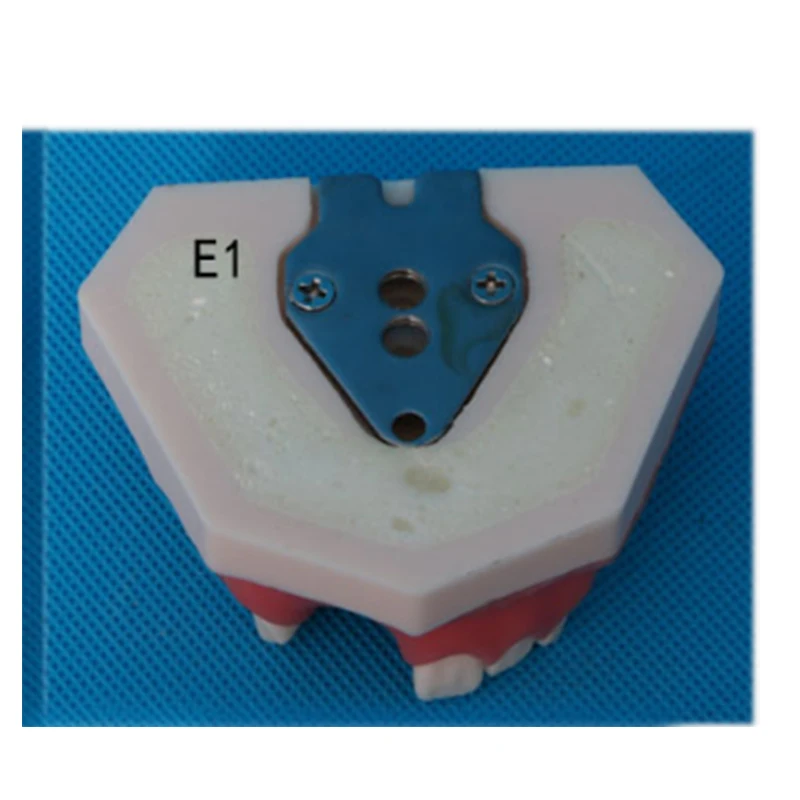 Edentulous Implant Practice Mandibular Jaw Model for Dentist Practice and training dental model Small iron piece