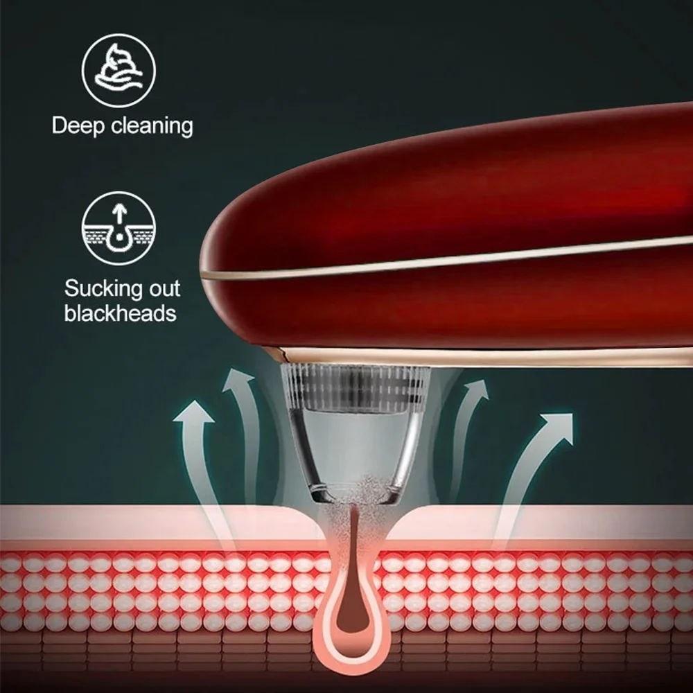 
Mkboo Visible Blackhead Remover Use Vacuum Blackhead Remover Home Skin Care Blackhead Remover Device With Good Price 