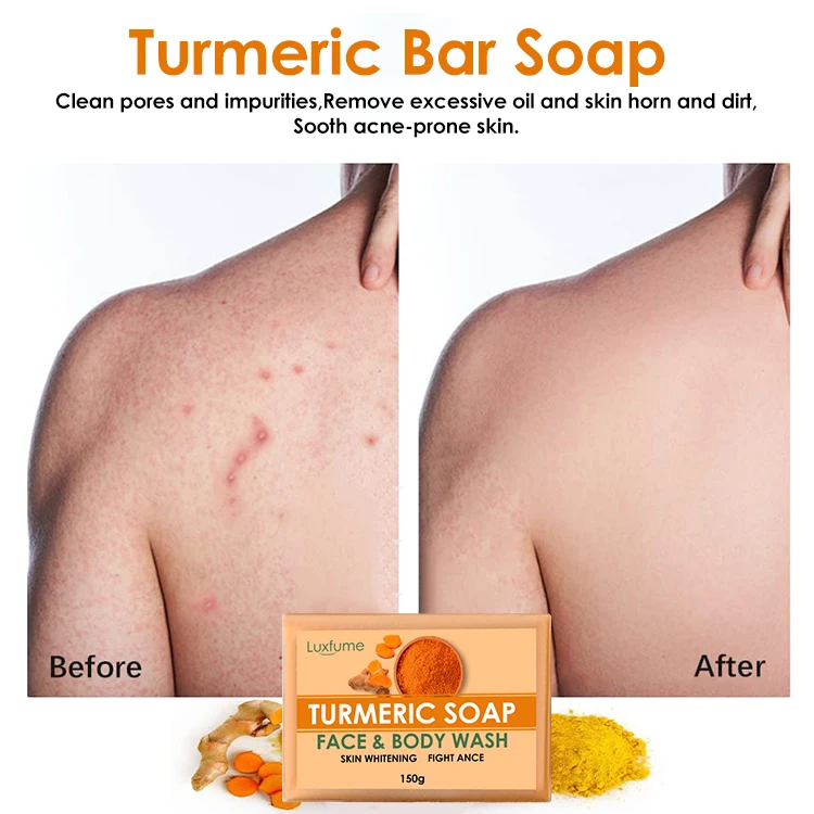 Luxfume Wholesale Turmeric Bar Soap Handmade Organic Turmeric Soap For Skin Whitening