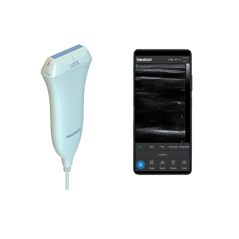 U20L USG Full Digital Mini Ultrasound Price Portable Ultrasound Machine Medical Instruments With Smartphone