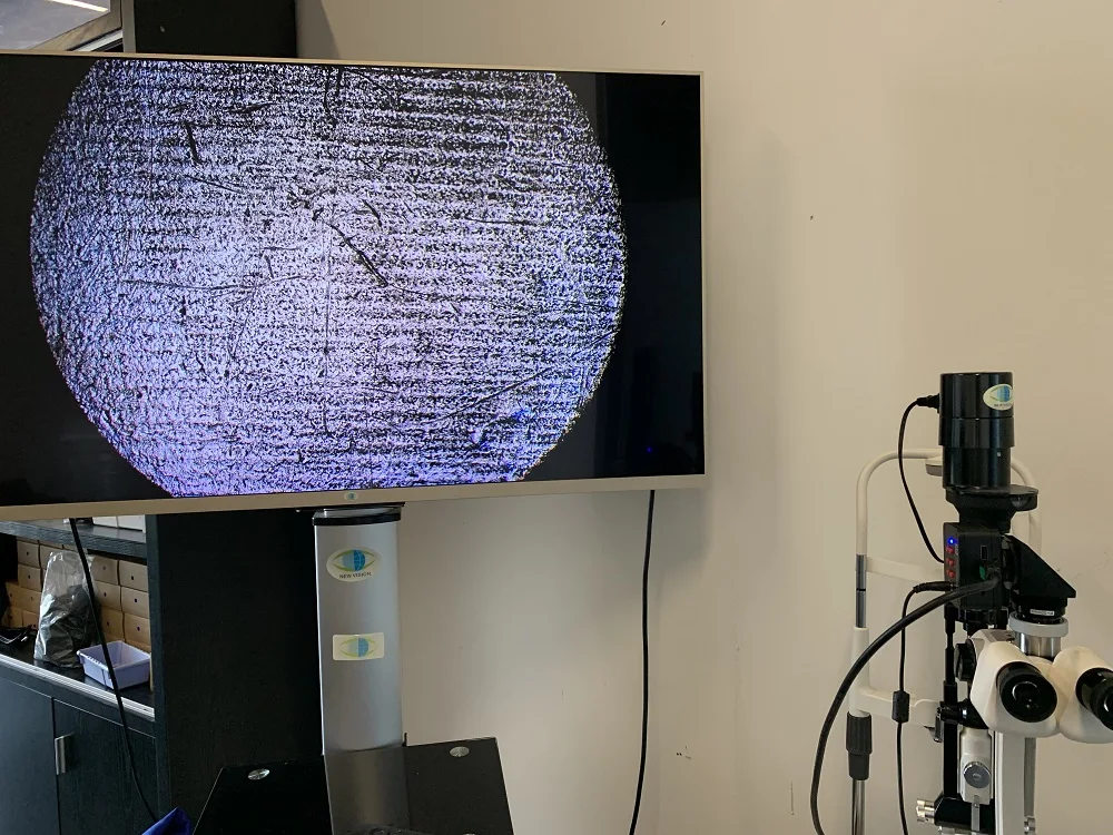 Beam Splitter for Zeiss, 66 vision, Mediworks Slit Lamp