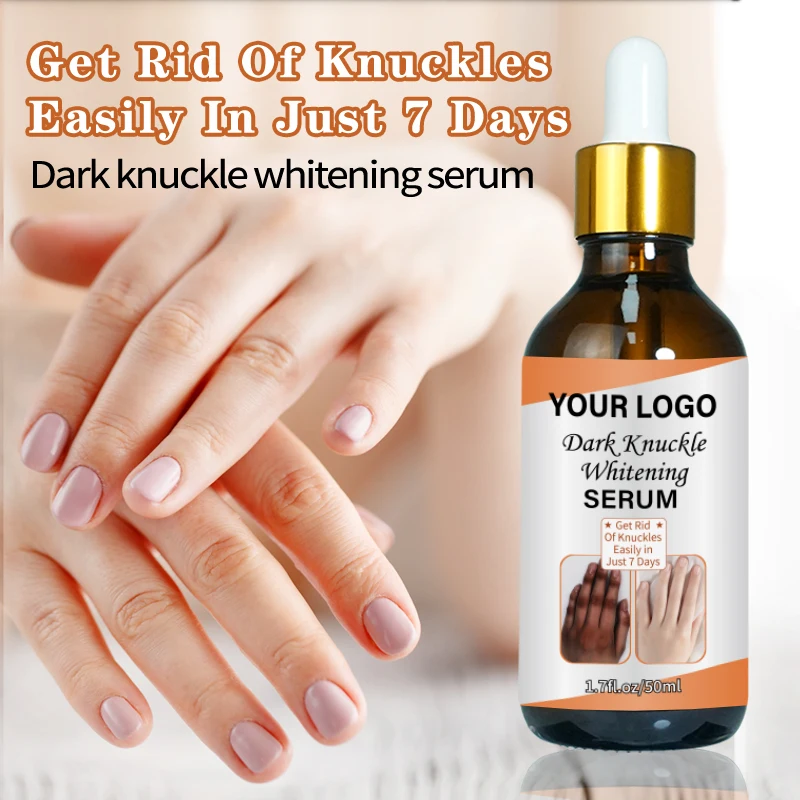 Фирменная Сыворотка для быстрого отбеливания суставов колена, сыворотка для удаления интенсивных пятен на коленях