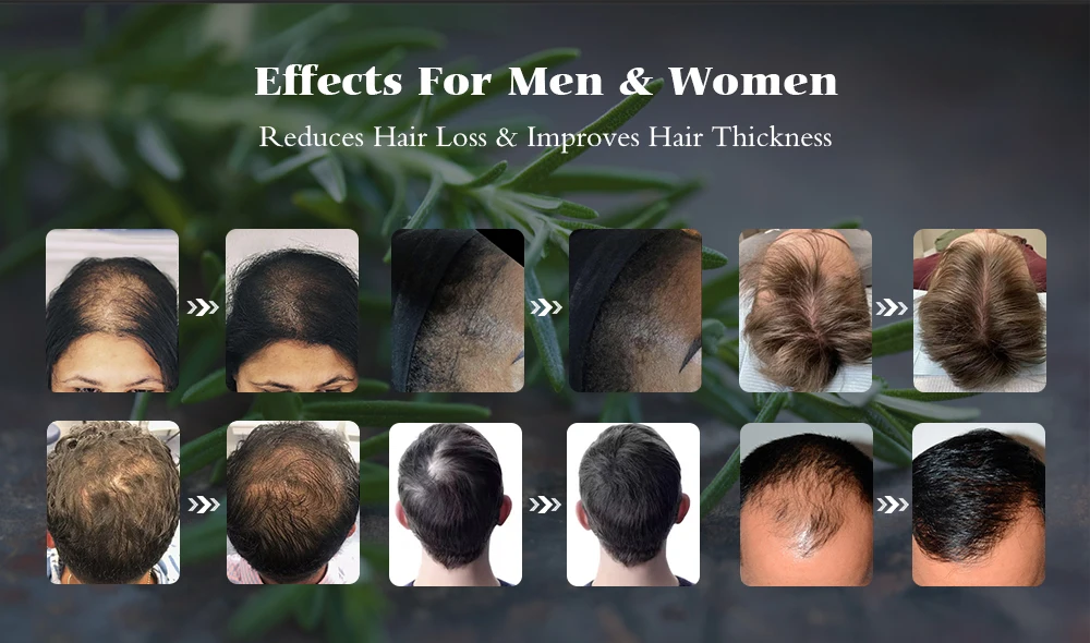 Keratin Protein Hair Treatment Serum Hair Loss Prevention Thinning Hair Thickening Tonic