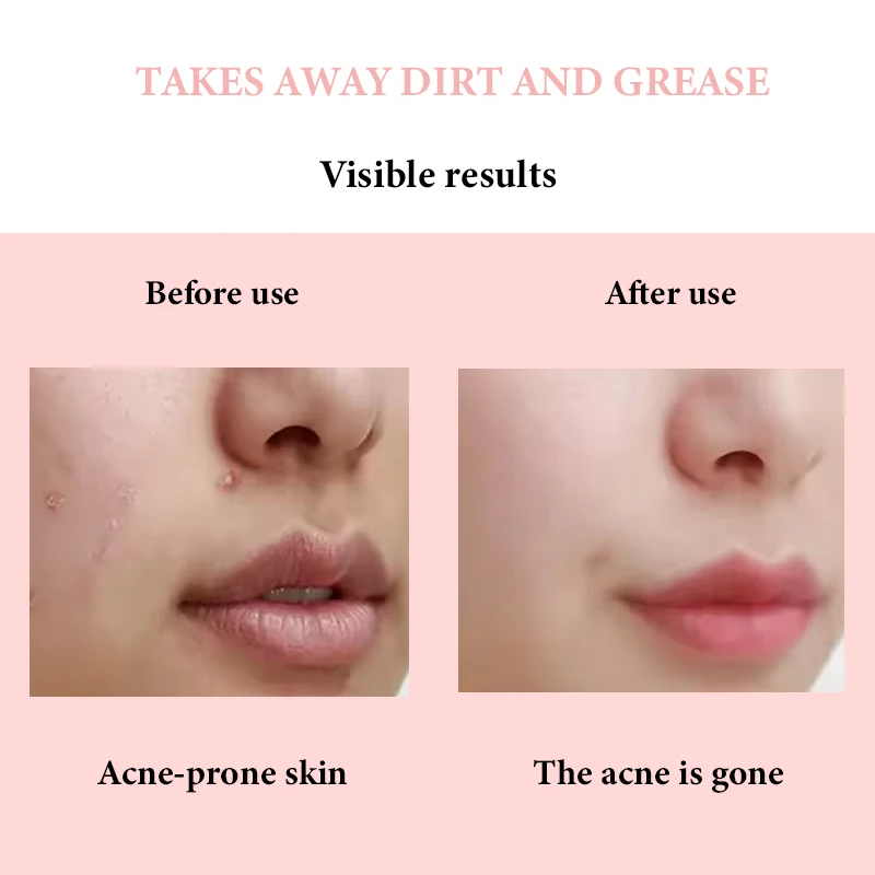 good molecules niacinamide brightening Glycolic Acid 9% exfoliating Toner pH3.3 skin whitening toner