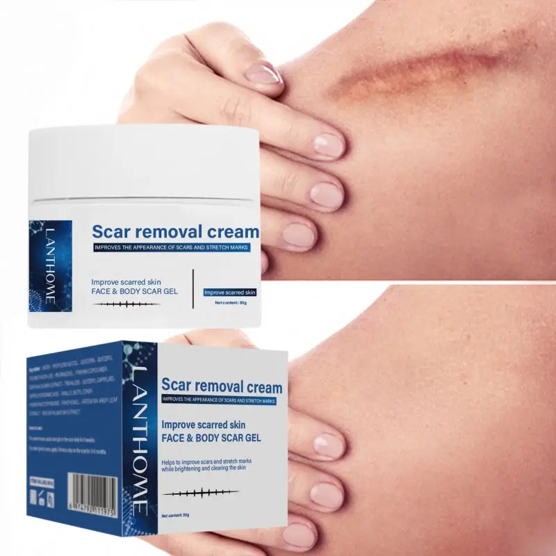 30g Old And Dark Spot On Leg Removal Cream Remove Postoperative Effectively Prevents Scar Proliferation After Surgery
