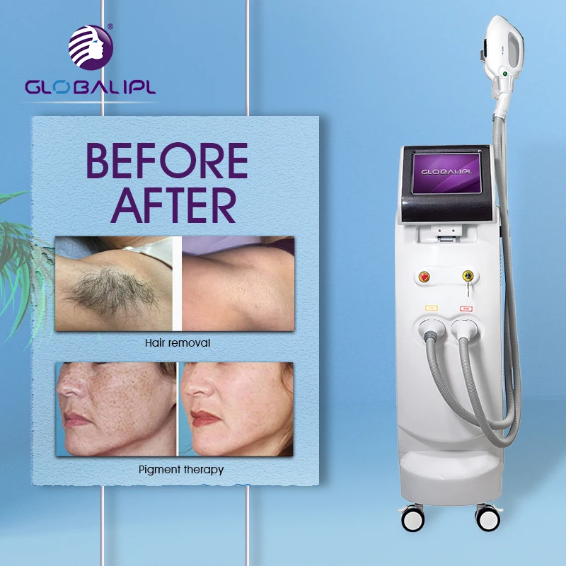 Manufacturer IPL Depilation Elight+RF+ND YAG Laser Price