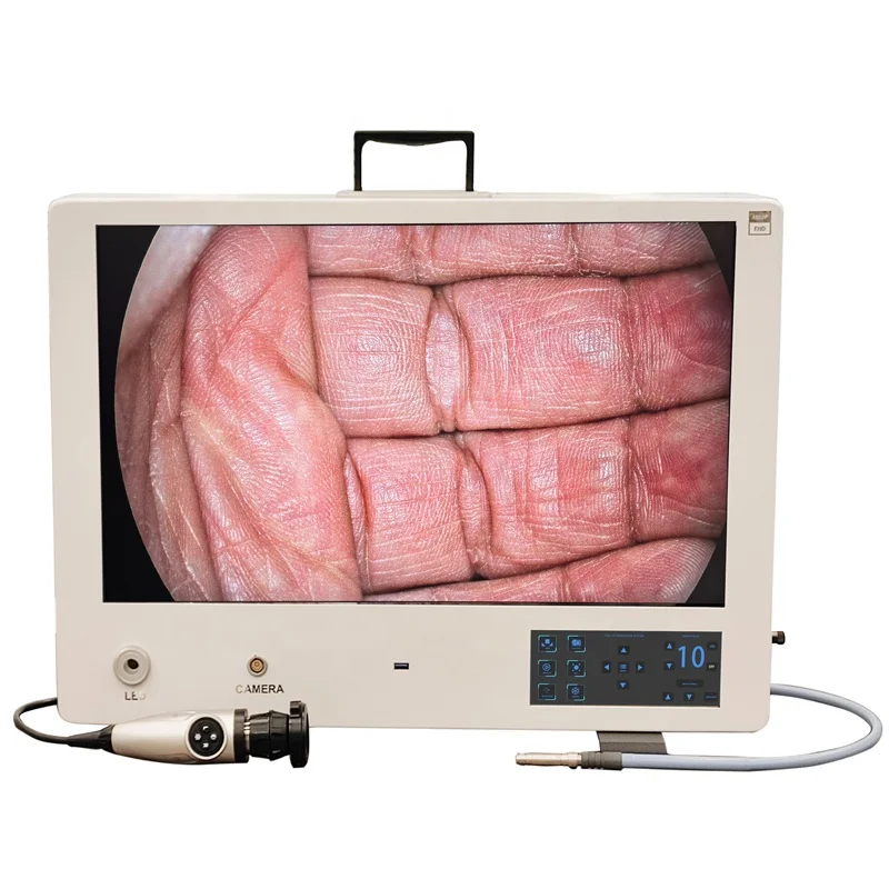 Affordable Compact Endoscope Camera System with Image Recording and Adjustable Monitor